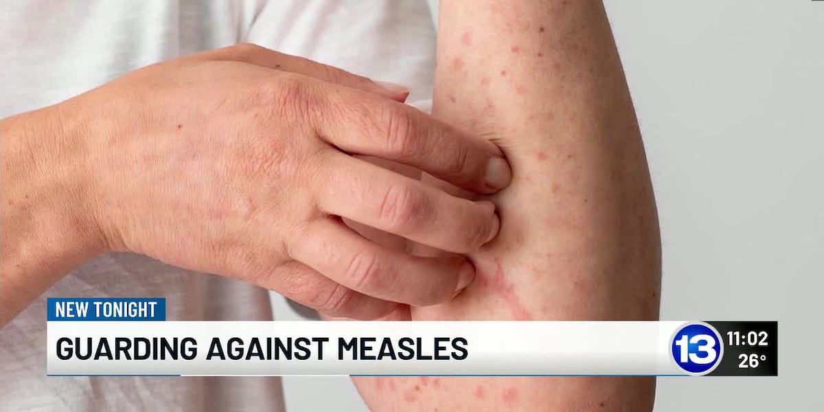 Guarding against measles, as outbreaks are reported across 20 states